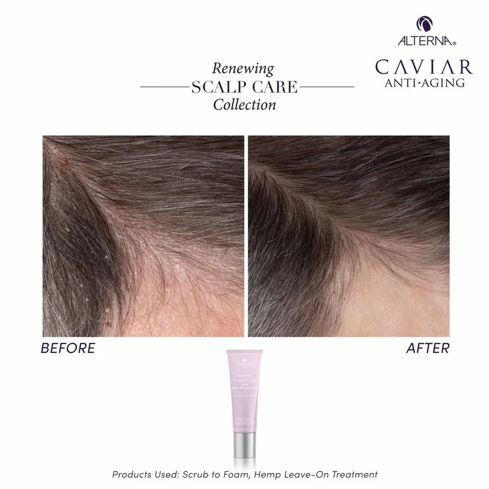 🪮 Alterna Renewing Scalp Care Hemp Leave-On Treatment 2.5 oz / 74 mL) 🎀